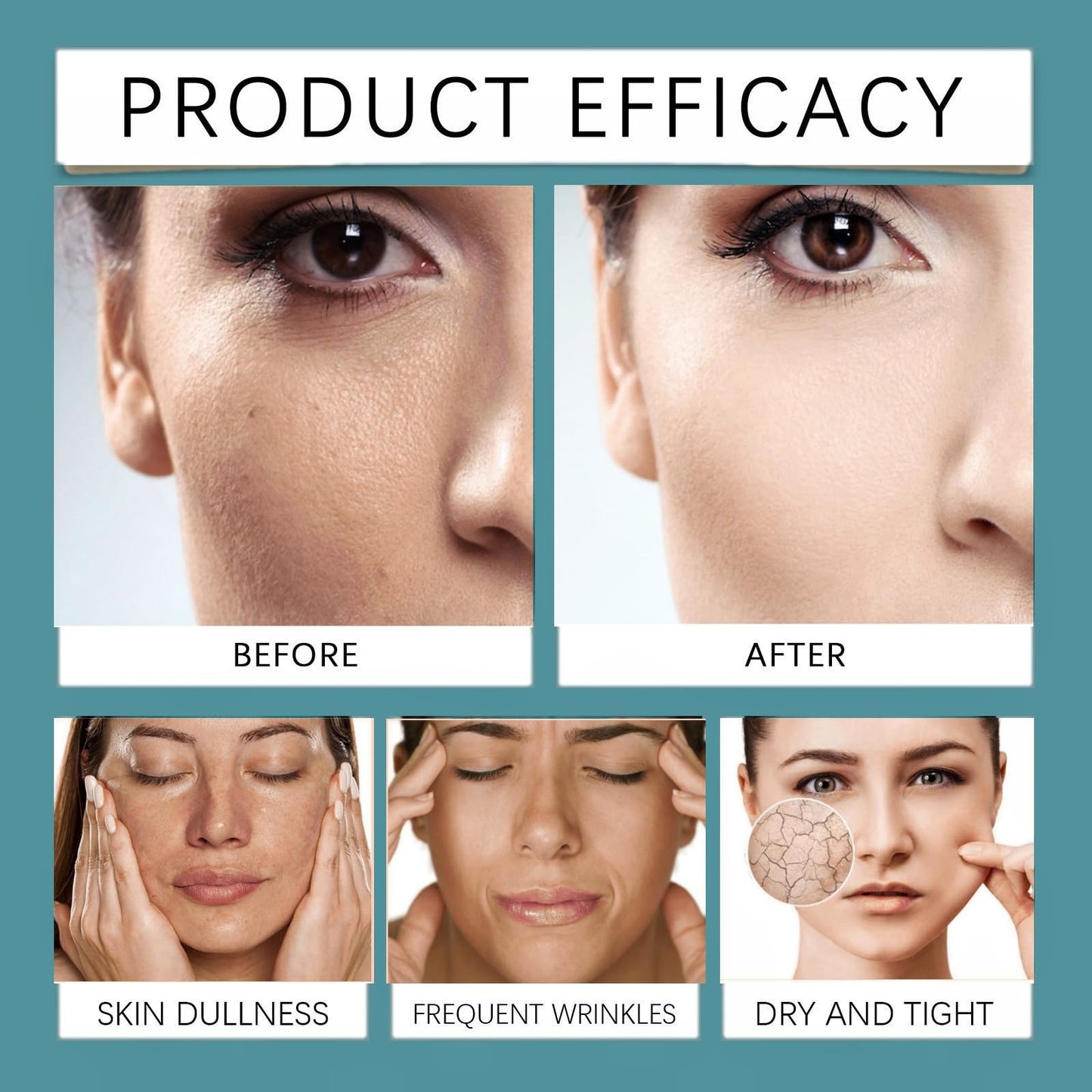 QinZiEn Total Package Serums,Hyaluronic Acid Serum,Hydrating Serum,Face Moisturisers,Collagen Ser-um for Face,Hyaluronic Acid Moisturiser,Anti Wrinkle Ser-um,Anti Aging Se-rum,Moist-uriser for Dry Skin Fac-e