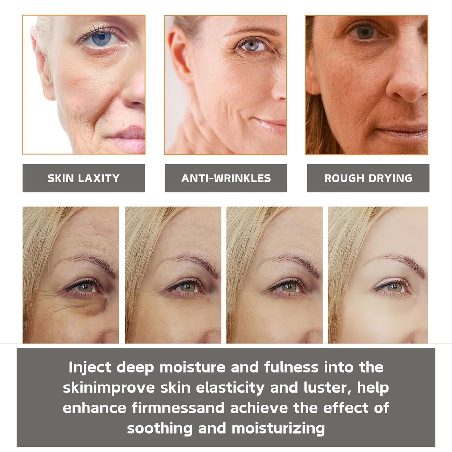 Cureluxe Pack of 3 Micro Needle Patches - Dissolving Microneedle Eye Patches with Vitamin E,Collagen,Hyaluronic Acid - Anti-Wrinkle Microneedle Patches - Collagen Eye Patches for Dark Circles & Puffy Eyes