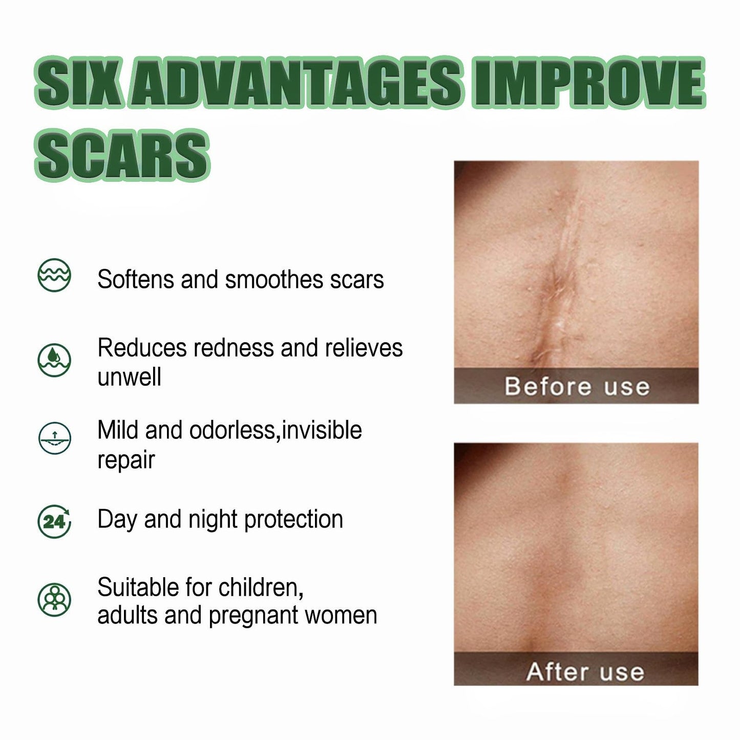 OuXing Wound Healing Oint-Ment,Relieve Skin Abrasions,Natral Healing Cream,Promote Skin HEA/ling Cream,Scab He/aling Cr/eam,Wo/und Cre/am Fade Scars,Wo/und He/aling Crea/m,Body Cre/am,WOU/nd Protection