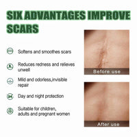OuXing Wound Healing Oint-Ment,Relieve Skin Abrasions,Natral Healing Cream,Promote Skin HEA/ling Cream,Scab He/aling Cr/eam,Wo/und Cre/am Fade Scars,Wo/und He/aling Crea/m,Body Cre/am,WOU/nd Protection
