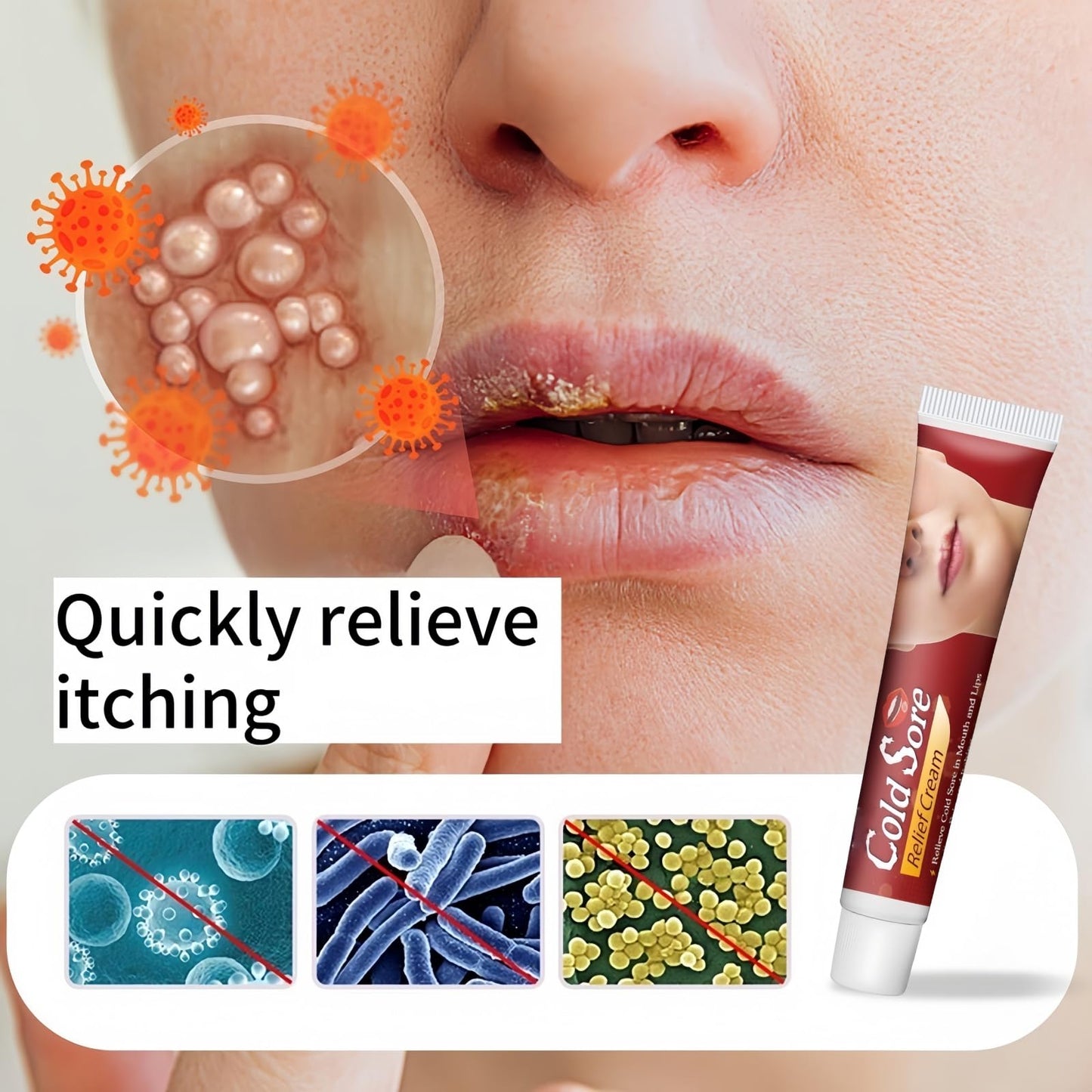 OuXing Cold Sore Treatment Cream,Cold Sore Cream,C/Old S/ore Treatment,C/Old S/ore C/Ream for Lips,Co/ld So/re Relief C/Ream,So/re Lips T/reatment,Mouth SOR/e T/reatment,Oral Gel Extra Strength,Lip Care