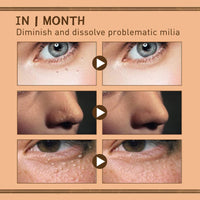 Cynamus Firming Eye Cream, Dark Circle Treatment Anti-Wrinkle Eye Cream Firming Eye Care For Mature Skin, Eye Cream Against Wrinkles For Dark Circles, Tear Bags And Swelling, 30g