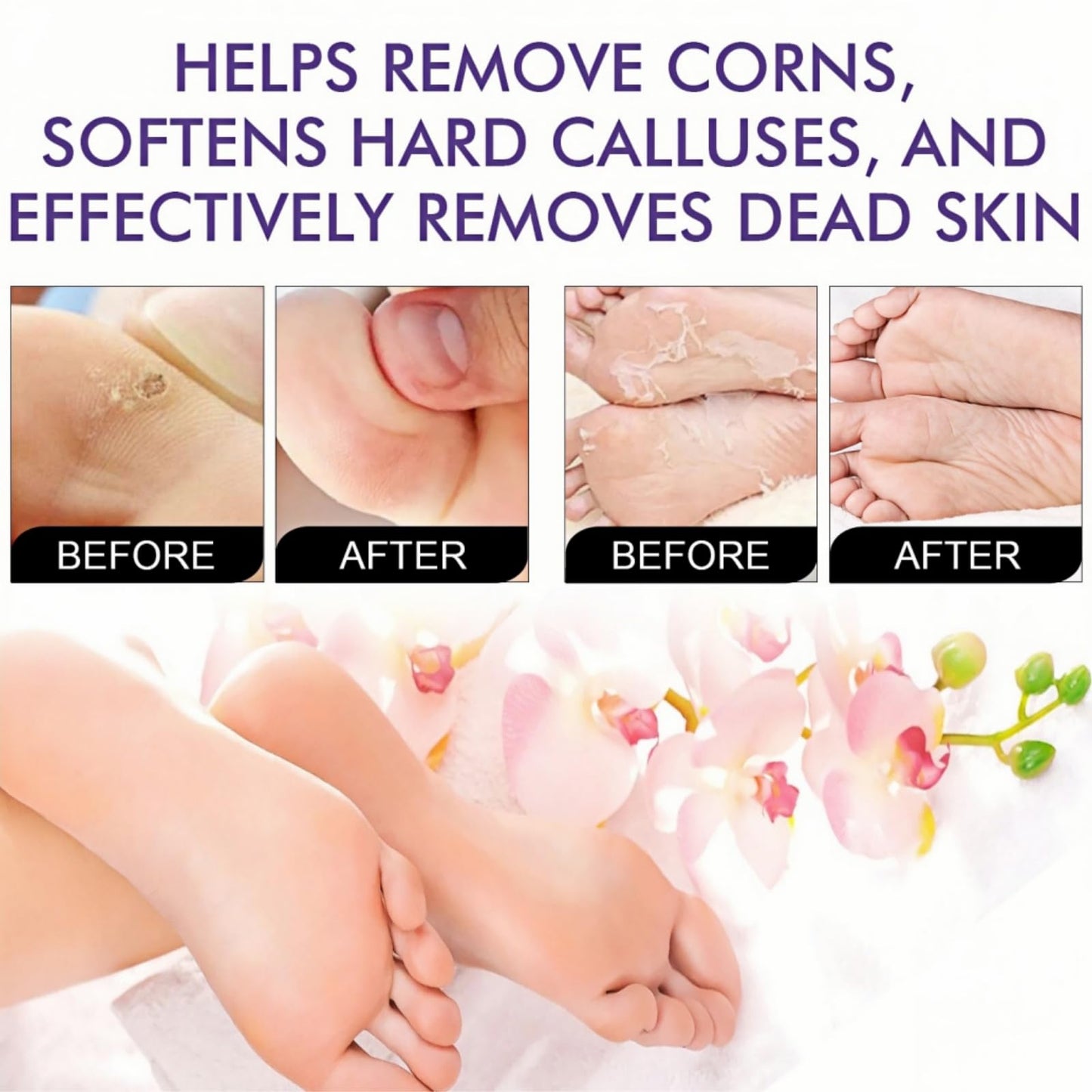 SEMECOMER 2-Pack Foot Peel Mask, Foot Peeling Mask for Hard Skin, Foot-Mask Callus Remover, Moisturising Socks for Feet Care, Effectively Removes Dry, Dead Skin & Repairs Cracked Heels - Lavender