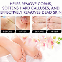 SEMECOMER 2-Pack Foot Peel Mask, Foot Peeling Mask for Hard Skin, Foot-Mask Callus Remover, Moisturising Socks for Feet Care, Effectively Removes Dry, Dead Skin & Repairs Cracked Heels - Lavender