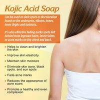Kojic Acid Soap, Kojic Soap Bar Skin Lightening Soap Bath Soap, Fades Age Spots, Freckles, Revitalize and Moisturizing Cleansing Soap for Dark Spots, Uneven Skin Tone