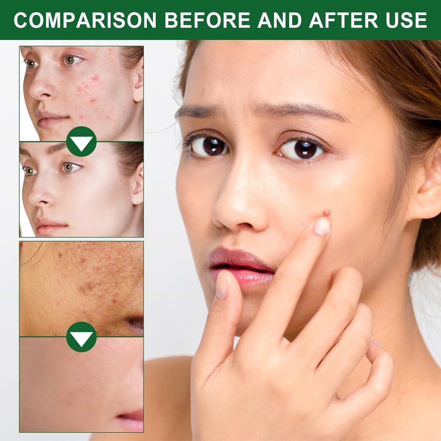 Siyinzu Dark Spot Remover Cream for Face & Body,Anti Aging Fac/e Cream,Dark Spot Remover,Freckle Removel Cre/am,Age Spot Remover for F/ace,Dark Spot Corrector Firming Fa/ce Moisturiser,Moisturiser Face Women