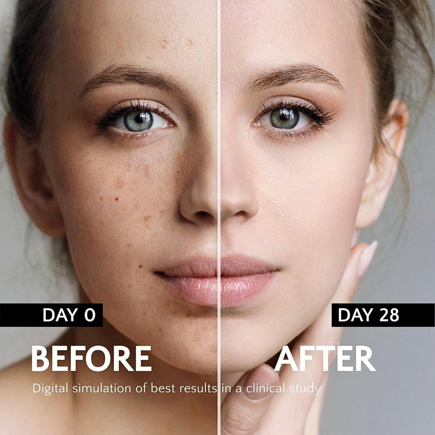 IZBEAUVO Dark Spot Remover For Face With Roller, Dark Spot Correcting Serum, Dark Spot Corrector For Age Spot Sun Spot Freckles Brown Spot, Melasma Treatment For Face, Hydrating Serum, Glow Serum