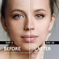 IZBEAUVO Dark Spot Remover For Face With Roller, Dark Spot Correcting Serum, Dark Spot Corrector For Age Spot Sun Spot Freckles Brown Spot, Melasma Treatment For Face, Hydrating Serum, Glow Serum