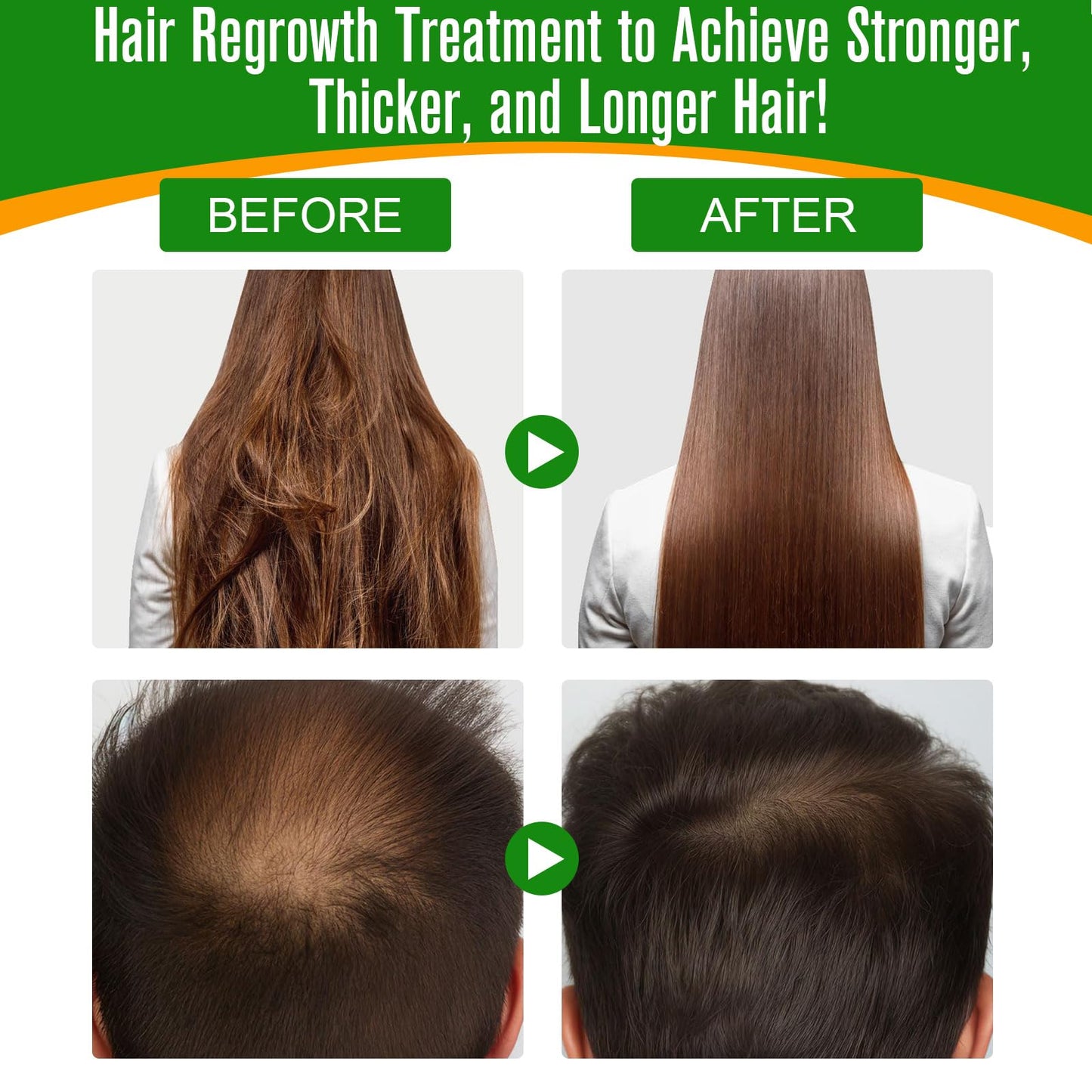 Generic 100% Pure & Natural Batana Hair Growth Oil-Eliminates Split Ends-Prevent Hair Loss-Increases Shine for Men & Women-For Thicker & Stronger Hair-Repairs Damaged Hair & Skin For Men & Women(60ml)
