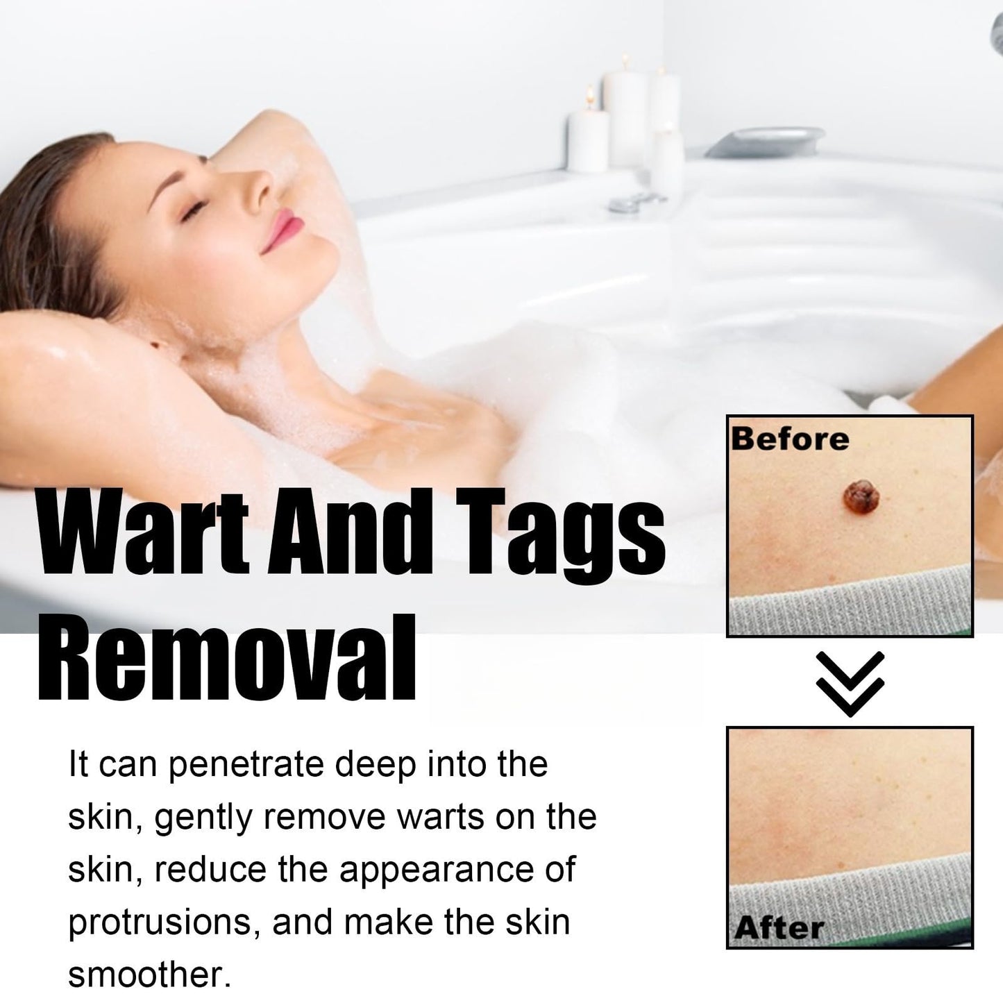 Jinjiar 2PCS Wart Remover Pen,Skin Wart Remover,Fast-Acting Wart Removal,Wart Freeze Removal,Foot & Hand Wart Strong Remover,Mole Remover,Natural Wart Re-Mover,Wart Re-Mover for Face,Flat Wa-rt Remover