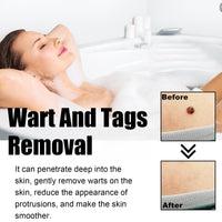 Jinjiar 2PCS Wart Remover Pen,Skin Wart Remover,Fast-Acting Wart Removal,Wart Freeze Removal,Foot & Hand Wart Strong Remover,Mole Remover,Natural Wart Re-Mover,Wart Re-Mover for Face,Flat Wa-rt Remover