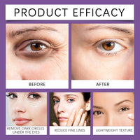 MEITREND Eye Serum for Dark Circles and Puffiness with 8% Caffeine,Retinol Eye Cream with Eye Roller,Anti Wrinkle Eye Moisturiser,Reduce Eye Bag & Fine Lines,Men Eye Cream,Caffeine Firming Eye Cream-For Dry