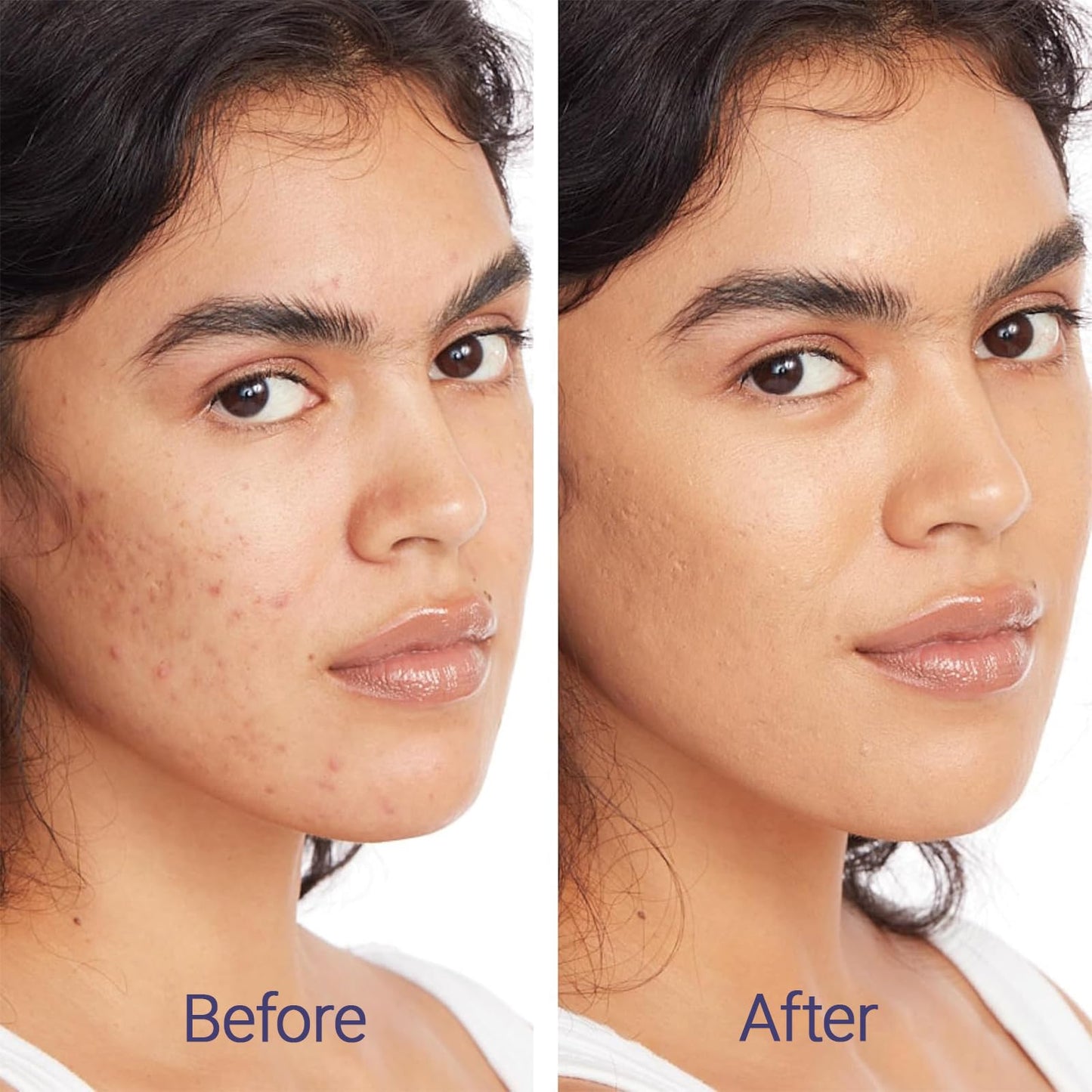 Guegine Body Coverage Perfector, Waterproof Body Makeup, All over Complexion Perfector, Body Foundation Cover Up Makeup Evens out Skin Tone for a Natural Look