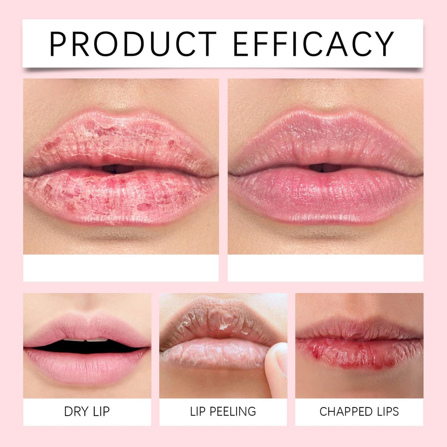 WujialingMM Plumpify Plumping Serum Oil, Plumpify Lip Oil Plumper, Natural Lip Boosting Serum, Moisturizing Plumping LipSerum, Hydrating & Nourishing Lips Oils, Reduce Lip Lines, EverydayLip Care (2Pcs)
