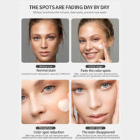 Tianyue Freckle Removal Cream,Anti-Freckle Crea-m- Dark Spot Removal Cream with Niacinamide & Vitamin C,Dark Spot Remover for Face & Body,Whitening Freckl-e Crea-m, Reduces Melasma,Improve Skin Dullness