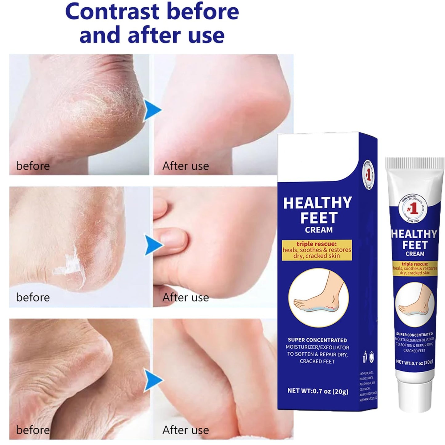 DMQ Cracked Heel Repair Cream, Healthy Feet Cream, Foot Cream for Cracked Heels and Dry Skin, Feet Hard Skin Remover, Instantly Boosts Moisture Levels, Creates a Protective Layer