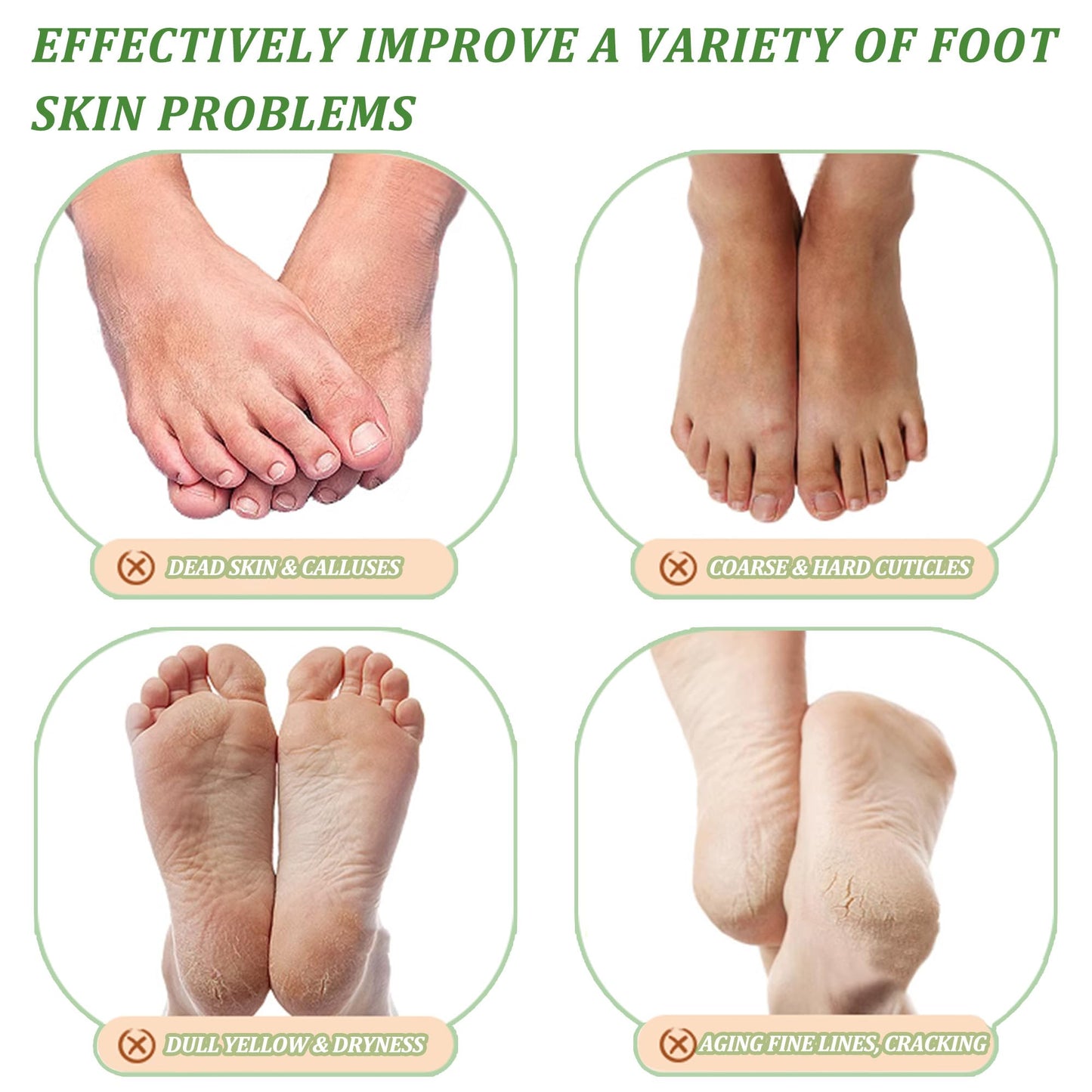 CGBOOM 3 Pack Foot Peel Mask Exfoliating Foot Mask Feet Peeling Socks Foot SPA Treatment for Baby Soft Feet Hard Dead Skin Remover Callus Repair Rough Cracked Heels (Tea Tree)