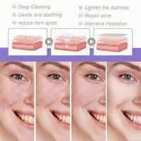 Bakuchiol Plumping Serum for Face,30ml Bakuchiol Serum with Niacinamide for Skin Brightening,Face Moisturizer f/or Women,Anti Aging S/erum f/or Women,Firming Cream fo/r Loose Skin