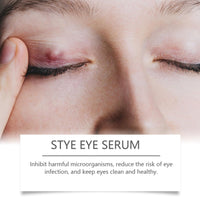 Stye Eye Treatment, MrCuvaryas Under Eye Serum,Natural Stye Eye Serum for Styes,