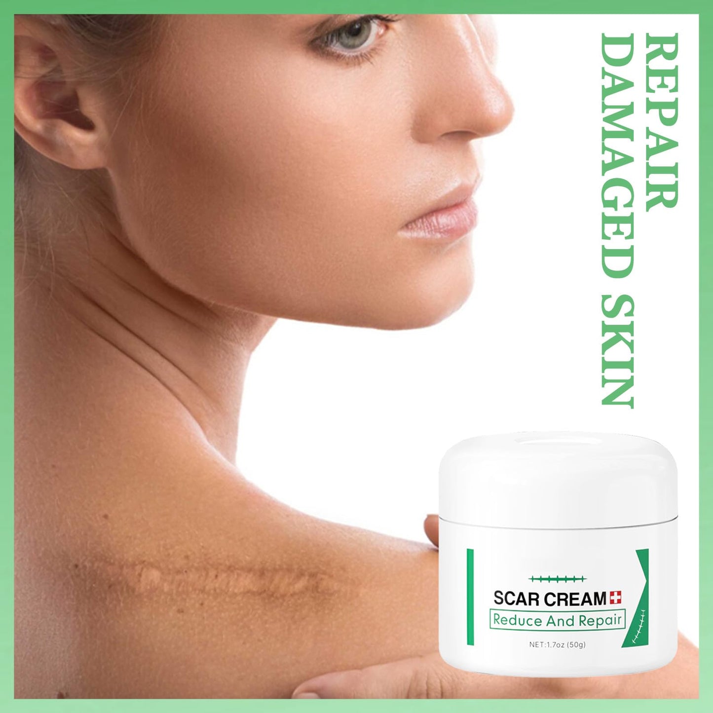 Scar Removal Cream for Face & Body - Treatment for New Scars, Stretch Marks, Acne Spots & C-Sections Treatment Cream, 50g, Natural Formula for Face and Body, Reduces Old and New Scars