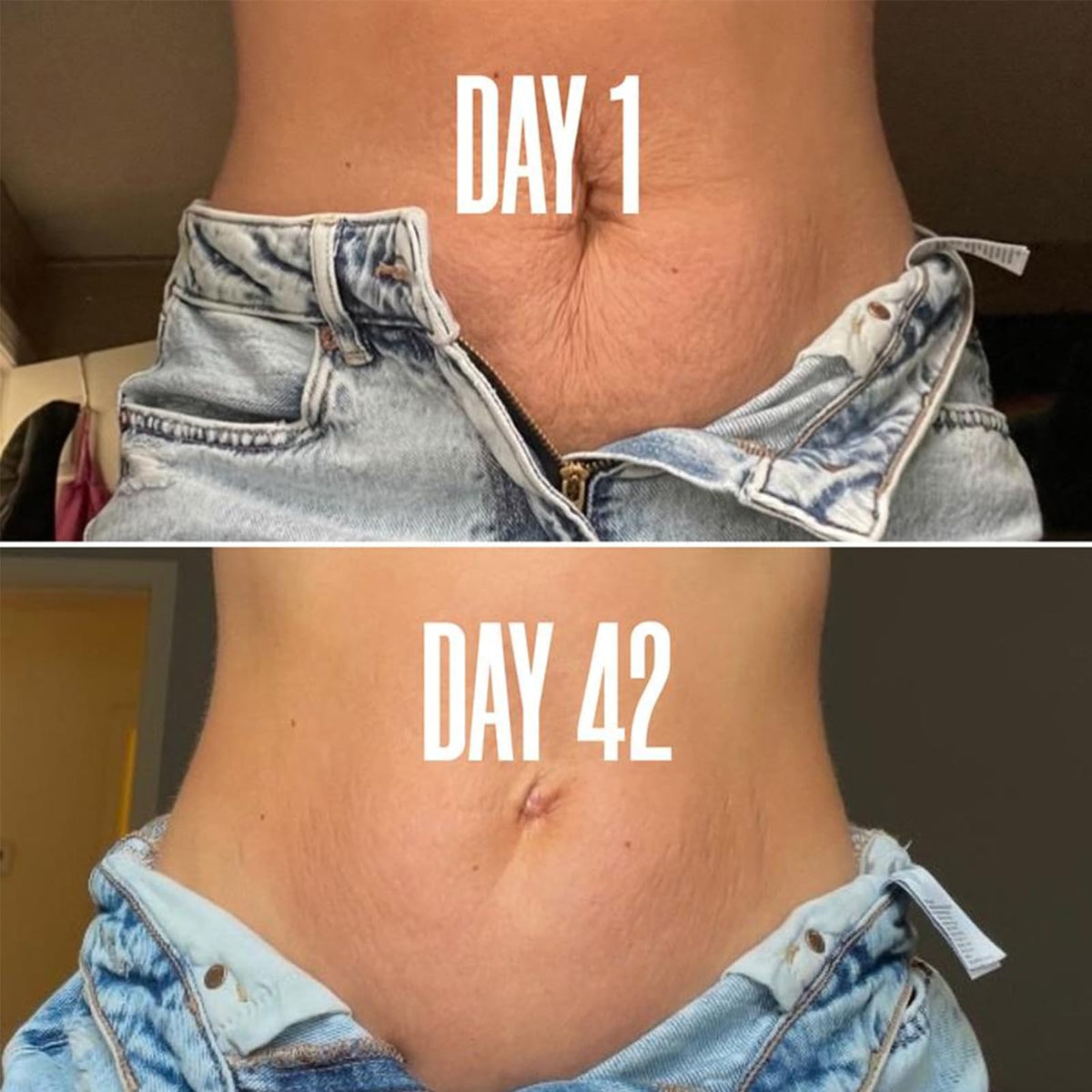 INSKIN B Flat Belly Firming Cream - Skin Firming and Tightening Body Cream Skin Tightening Moisturizing Body Tightening Crea-m for Tummy, Thighs, Arms, Butt - Stretch Mark
