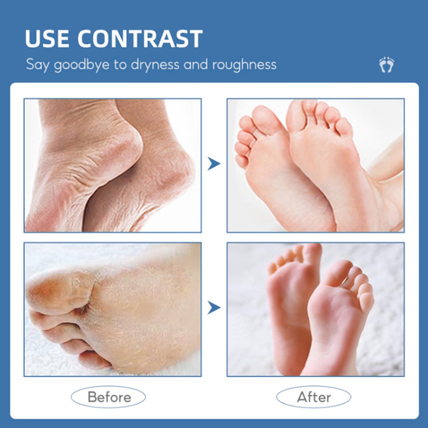 ISBEAUSOLS 60% Urea Cream - Cracked Heel Repair Cream For Feet and Hand - Foot Cream for Cracked Heels and Dry Skin - Urea Cream 60 Percent for Feet - Maximum Strength for Hand, Foot and Body Care