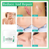 Scar Removal Cream for Face & Body - Treatment for New Scars, Stretch Marks, Acne Spots & C-Sections Treatment Cream, 50g, Natural Formula for Face and Body, Reduces Old and New Scars
