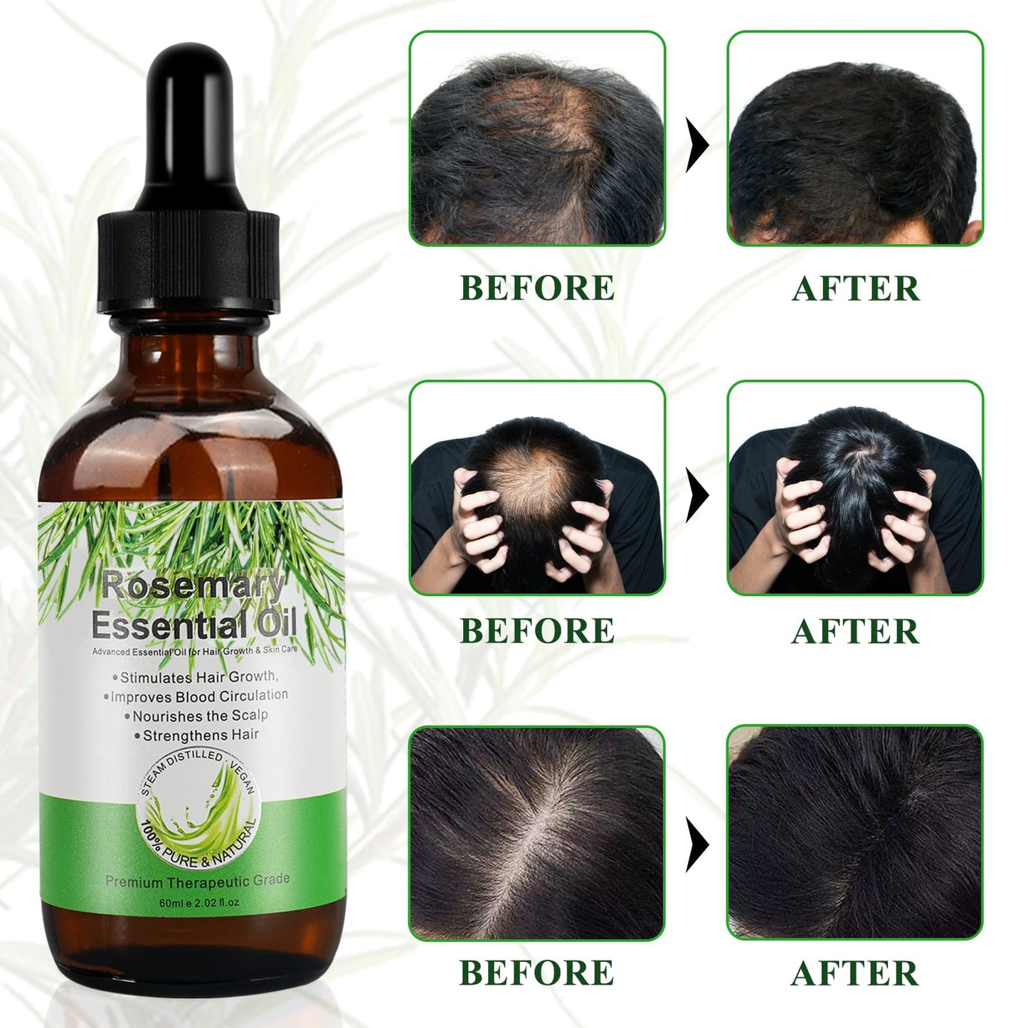 JCZQDRPC Organic Rosemary Oil for Hair Growth with Scalp Massager, 60ml Natural Organic Rosemary Essentia Oil, Pure Essential Oil for Skin & Hair Care, Hair Loss Treatment for Hair