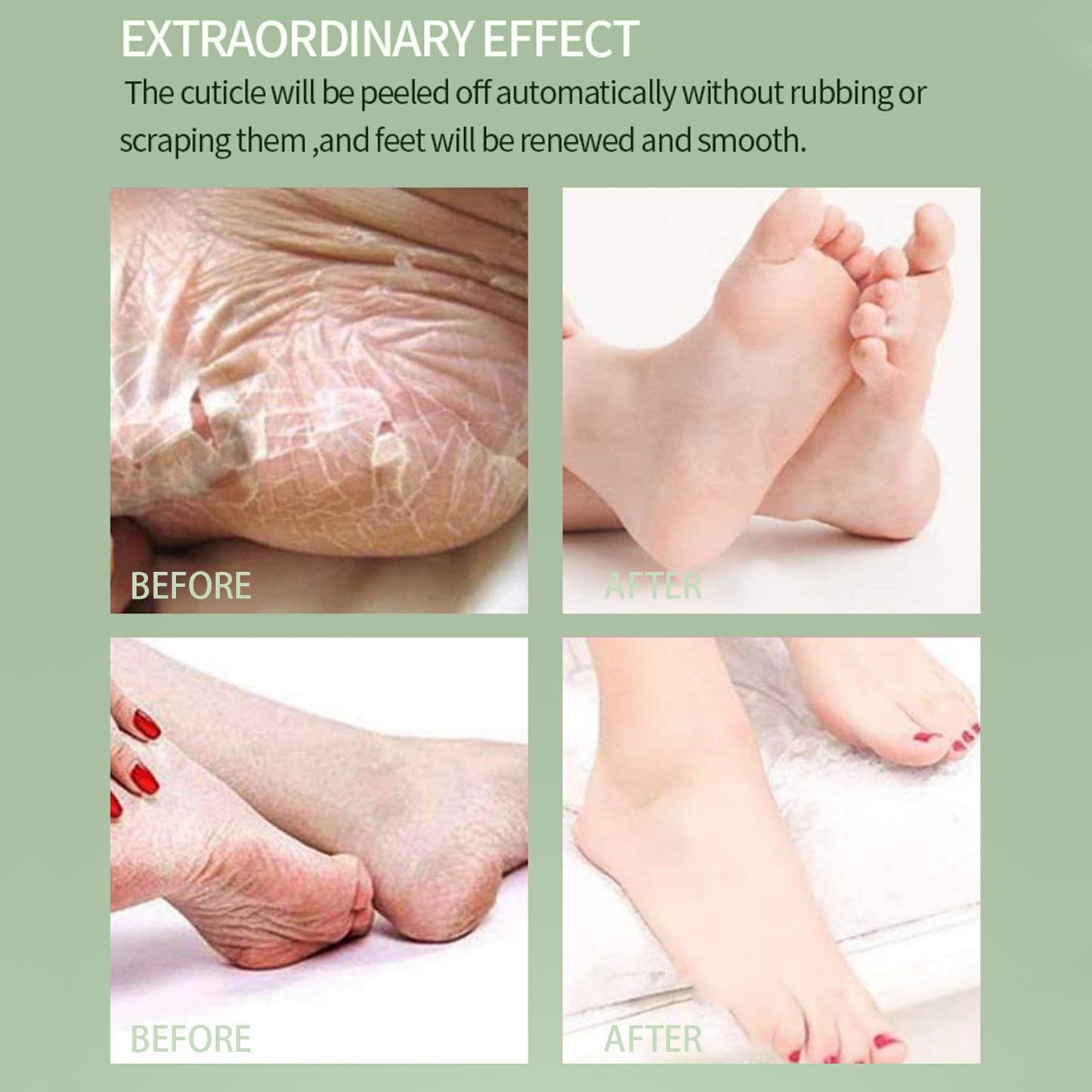 AuraAnge 4 PCS Aloe Vera Foot Peel Mask - Exfoliating Socks for Callus Removal - Cracked Heels, Dead & Dry Skin. Moisturizing for Soft, Smooth Feet