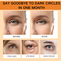 TBeautfave 2PCS Lumibalm for Under Eye Bags & Puffiness - Turmeric Retinol Eye Cream Stick - Hydrating Eye Balm Stick Reduces Fine Lines, Dark Circles, Anti-Aging Eye Brightener