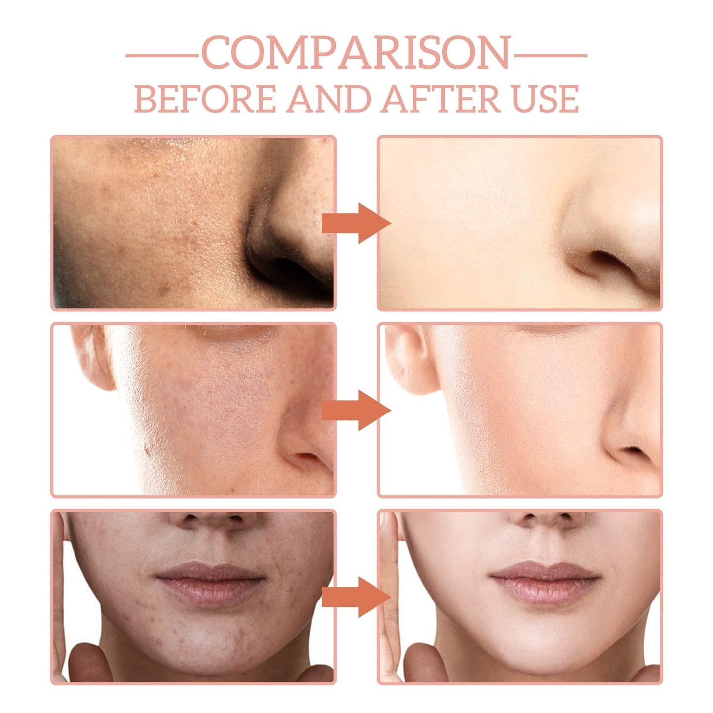 Bee Ven-om Cream,Bee Ven-om Wrinkle Removal Skin Treatment Cream,Be-e Ven-o-m Wrinkle Removal Cre-am,Boto Be-e Ve-n-om Wri-nkle Rem-oval Crea-m,Anti-Aging Moisturizer for All Skin Types