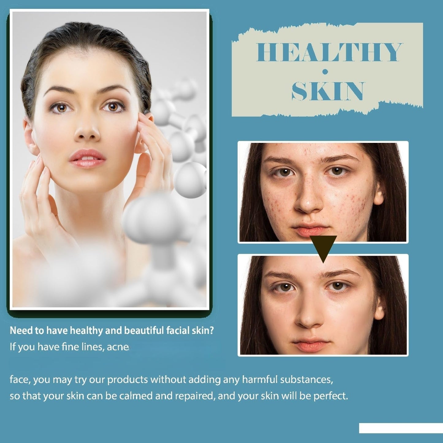 OuXing Dark Spot Correcting Glow Serum,Nicotinamide Facial Serum,5% Nicotinamide Seru-m,Spot Remover for Face,Hydrating & Brightening S-erum,Da-rk Spo-t Se-rum,Niacinamide Dar-k Sp-ot Remover,Face Ser-um