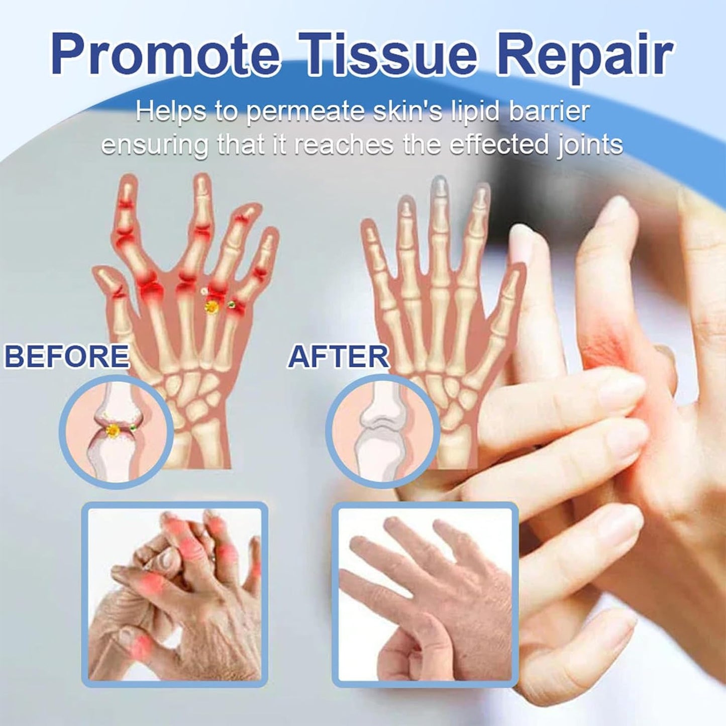 KoolShiro 2Pcs Magnesium Pa-in Relief Cream, Professional Joint Magnesium Cream for Relief, Natural Joint Gel Effective Relieffor Back, Neck, Hands, Knees