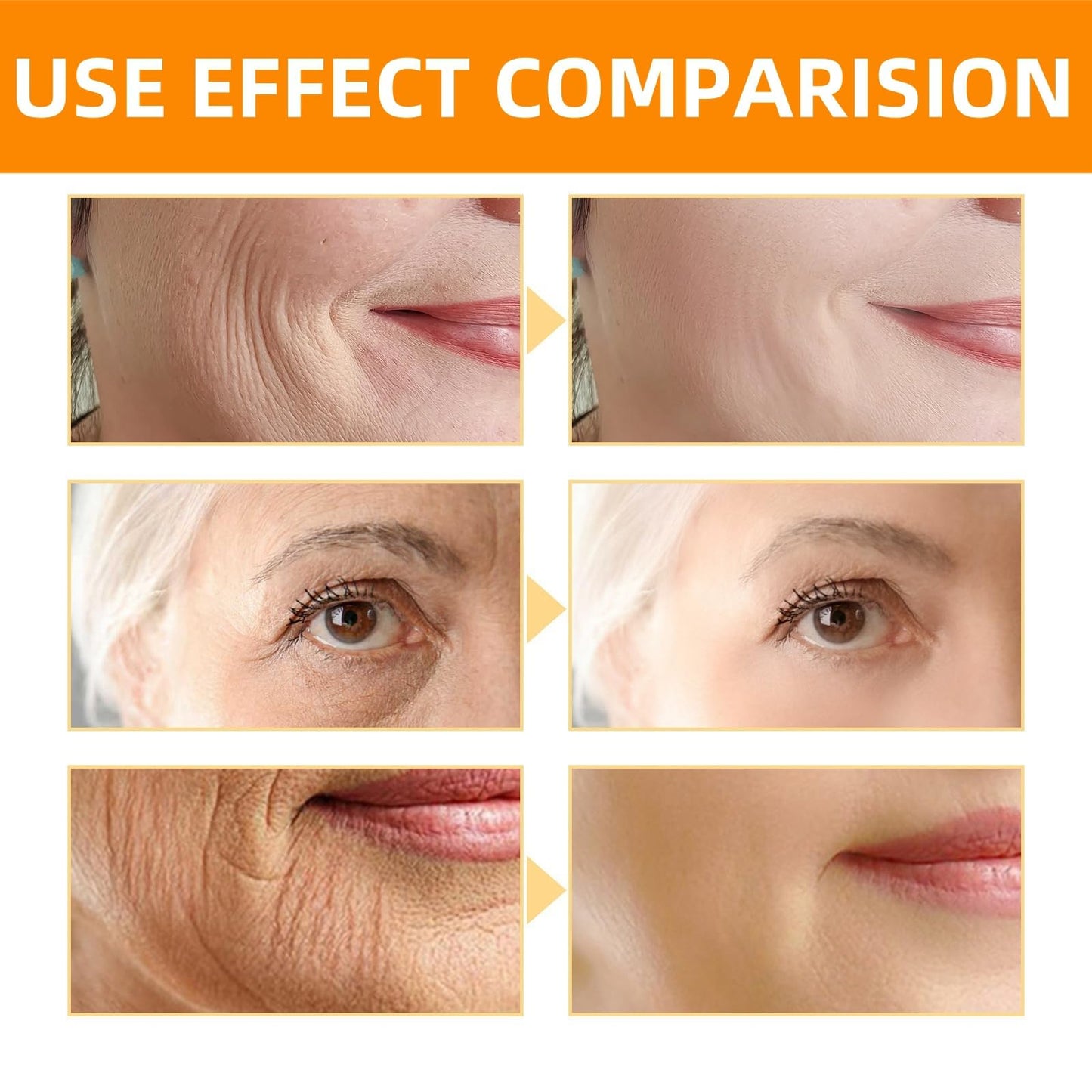 Siyinzu Bee Venom Wrinkle Removal Cream,Bee Venom Anti-Wrinkle Cre-am,B-ee Ven-om Skin Firming Cream,B-ee Ven-om Cre-am,Skin Treatment Creams for women,Anti Aging Face Serum,Sk-in Tightening Creams for Face