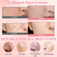 Ledeak Collagen Jelly Cream, Anti Aging Face Moisturiser with Niacinamide & Hydrolyzed Collagen, Reduce Fine Lines, Boost Skin Hydration & Glow, Korean Skincare for All Skin Type(50g)
