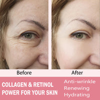 SEFUSON Collagen Cream for Face with Retinol and Hyaluronic Acid, Anti Wrinkle-Anti Aging Cream, Night and Day Anti Aging Skincare Facial Moisturizer, Face And Neck Cream(50ml)