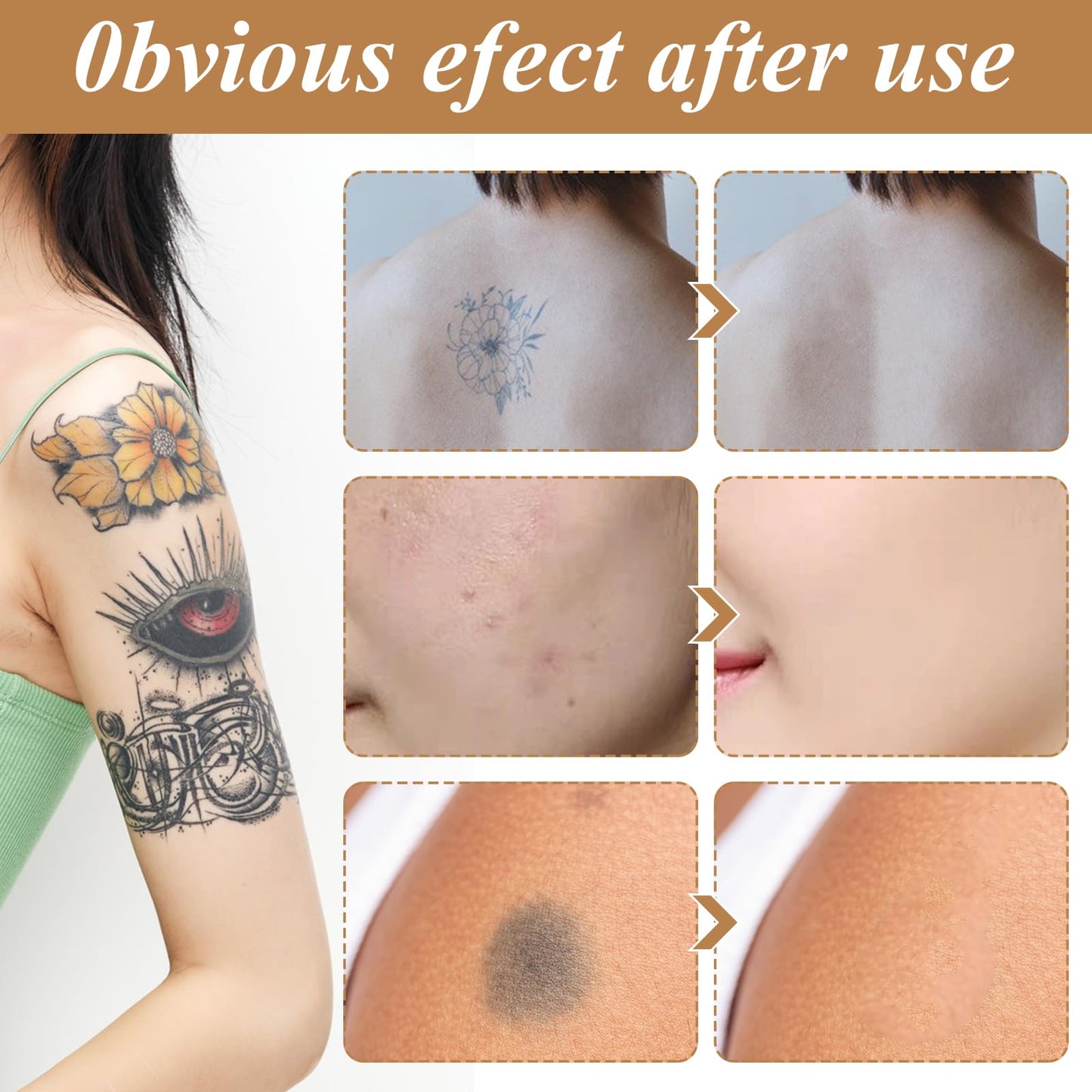 Nadiaen Tattoo Cover up Makeup Waterproof & Sweatproof Tattoo Concealer Full Coverage Body Concealer Hidden Spot Birthmarks Scars for Men and Women