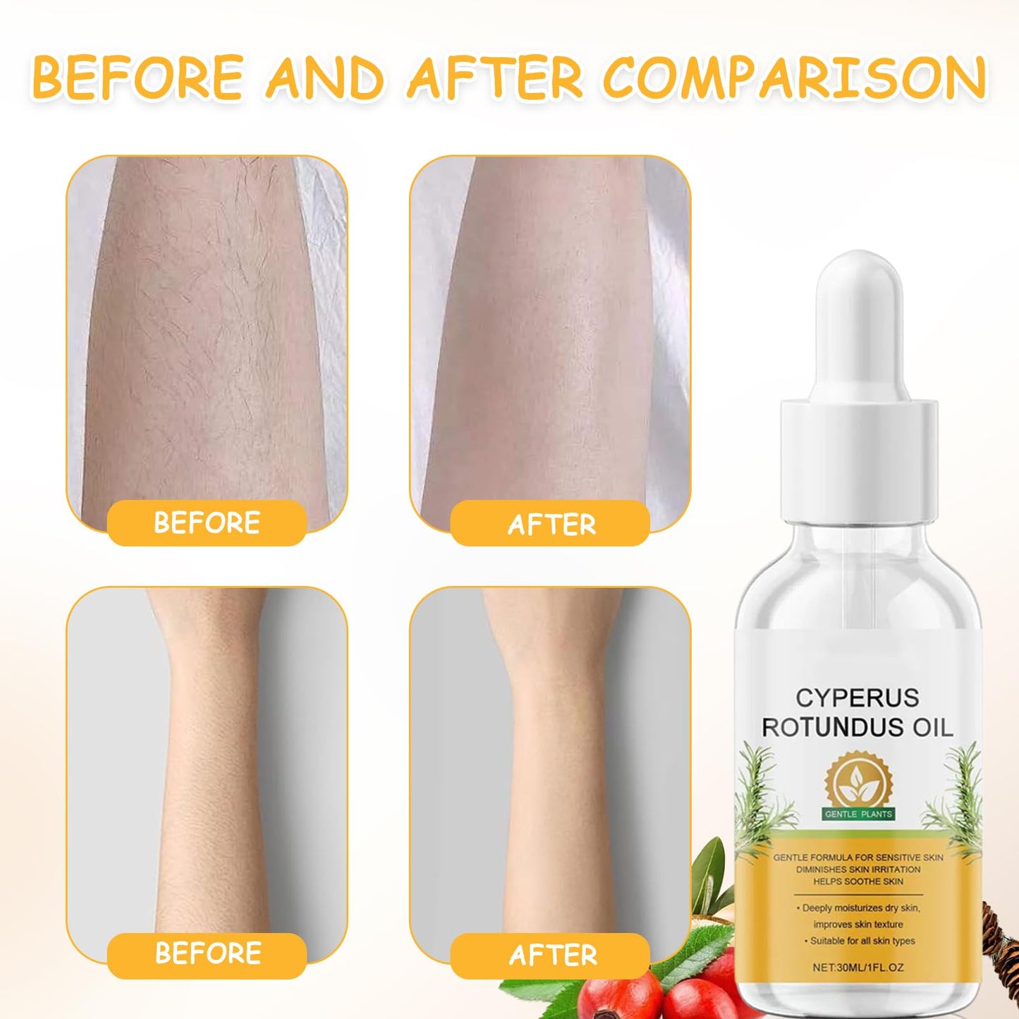 Kighdel 2 PCS Cyperus Rotundus Oil,Natural Ingredients Cyperus Oil,Cyprus Rotundus Oil,Multi-purpose Body Hair Reduction Oil,Gentle & Effective,Moisturizing & Soothing,for All Skin Types(30ml)
