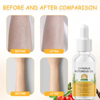 Kighdel 2 PCS Cyperus Rotundus Oil,Natural Ingredients Cyperus Oil,Cyprus Rotundus Oil,Multi-purpose Body Hair Reduction Oil,Gentle & Effective,Moisturizing & Soothing,for All Skin Types(30ml)
