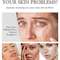 Dark Spot Cream,Anti Aging Face Cream for Freckles&Hyperpigm/entation,Spot Treatment,Skin Tightening Cream for Face,Skin Whitening Cream,Trane/xamic Acid&Niacinamide Facial Moisturizer,Gentle Formula