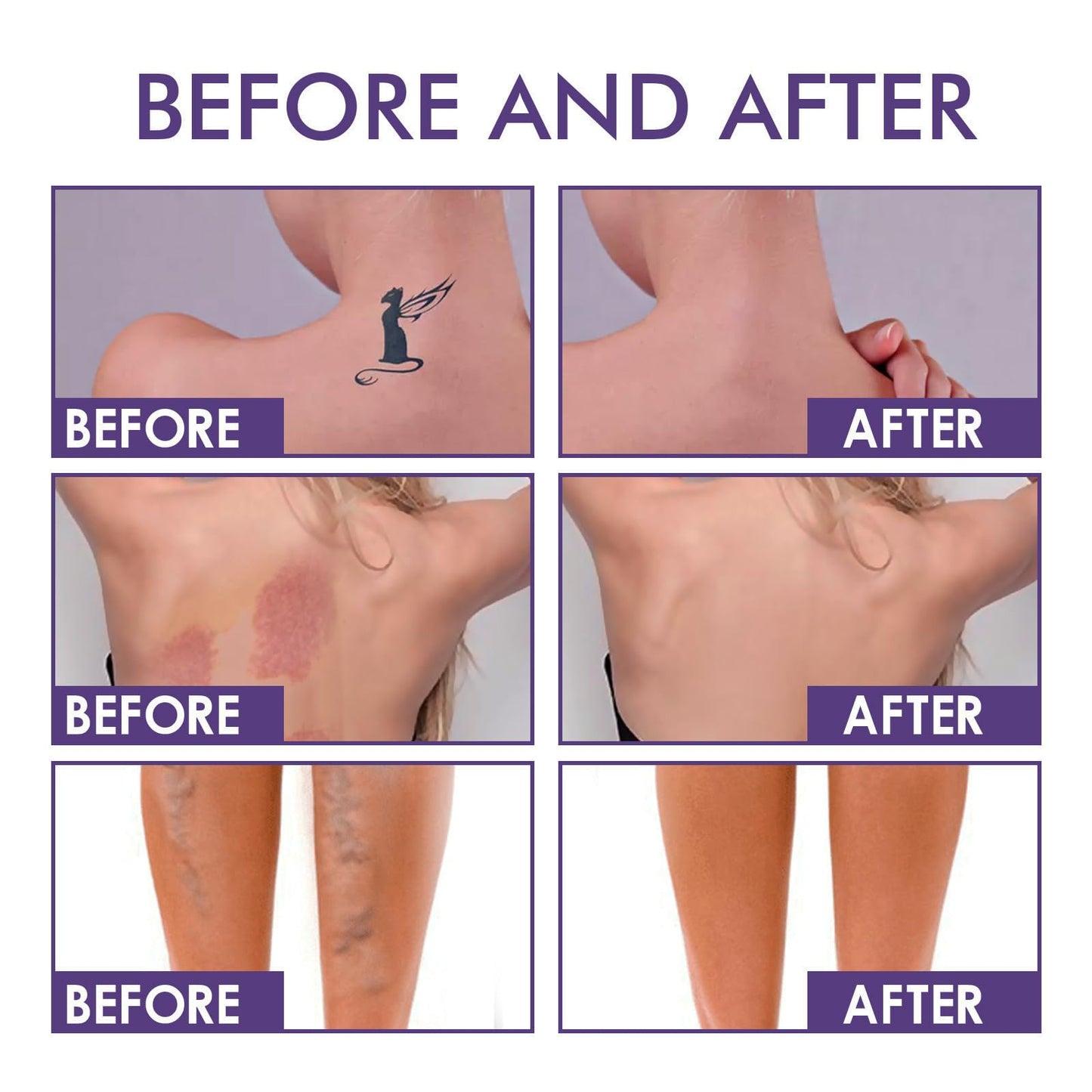 HERBINSOLS All Over Body Complexion Perfector with Brush - Waterproof Body Coverage Perfector Tattoo Cover up Makeup Cream - Long-Lasting Full Coverage Body Concealer Cream for Legs,Body Foundation