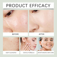 Xinyig 100ml Zero Film Cleansing Oil,Deep Cleansing Oil for Face,Natural Facial Oil Cleanser,Korean Double Cleaning for A Clear, Natural Complexion,Moisturizing Oil Cleanser,Light Cleansingoil for Women