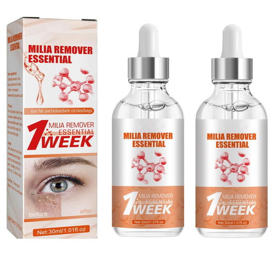 IZBEAUVO 2PCS Milia Remover Serum, Milia Remover for Face Fast-Acting Milia Spot Remover, Anti-Aging Eye Serum for Dark Circles and Puffiness, Reduces Wrinkles Saggy Skin & Puffy Eyes