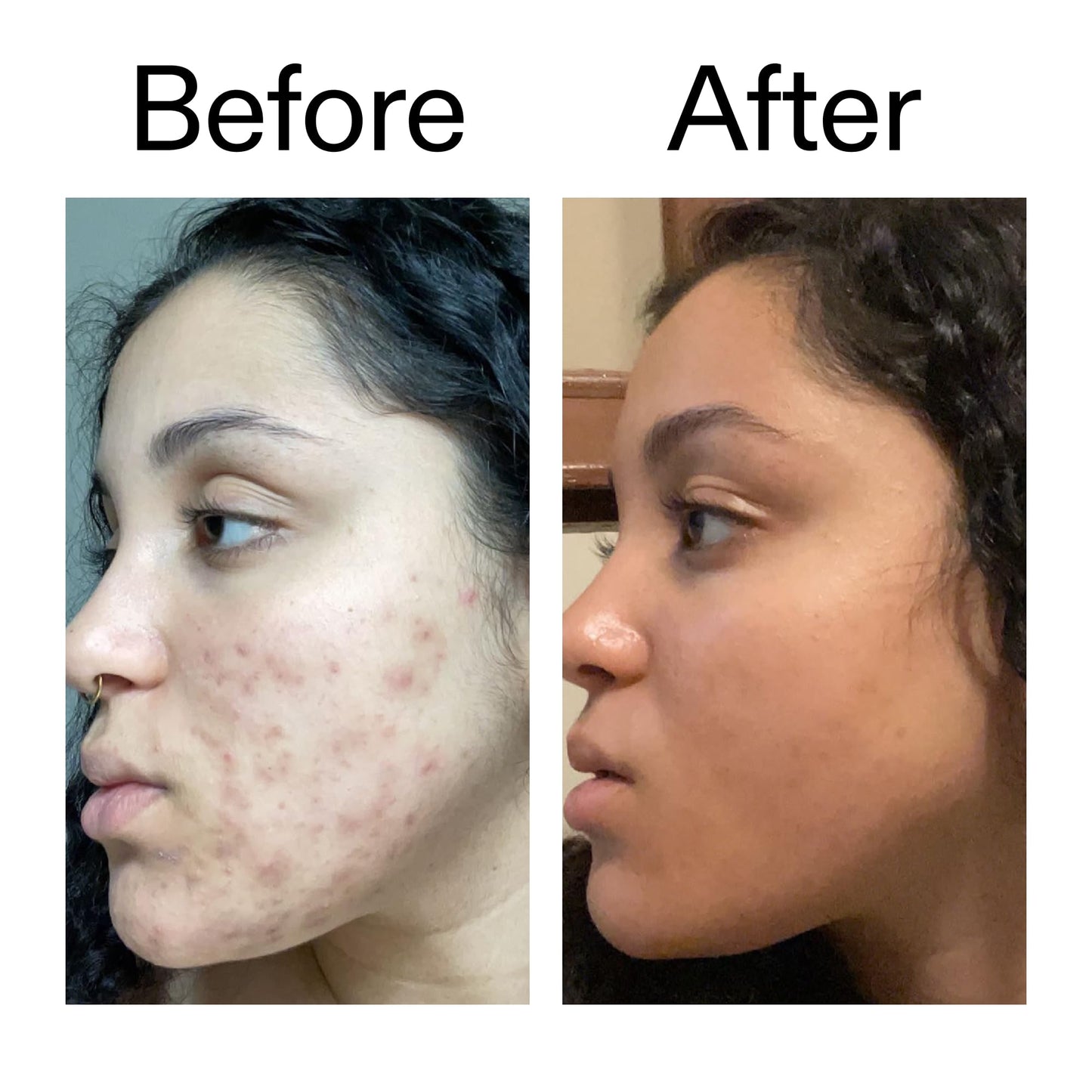 The INKEY List 2% Tranexamic Acid Serum 30ml