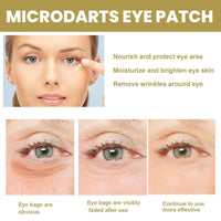 SingHao 3pcs Anti Wrinkles Micro Needle Patches,Dissolving Microneedle Eye Patches,Anti Wrinkle Patches,Under Eye Patches,Dark Circles & Puffiness Treatment,Under Eye Mask,Micro Needle Patches for Women