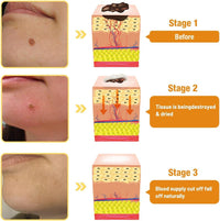 ALLILUYAA 2PCS LIPOGO Bee Venom Cream, Lipogo Professional Bee Venom Cream Gel for All Skin Types