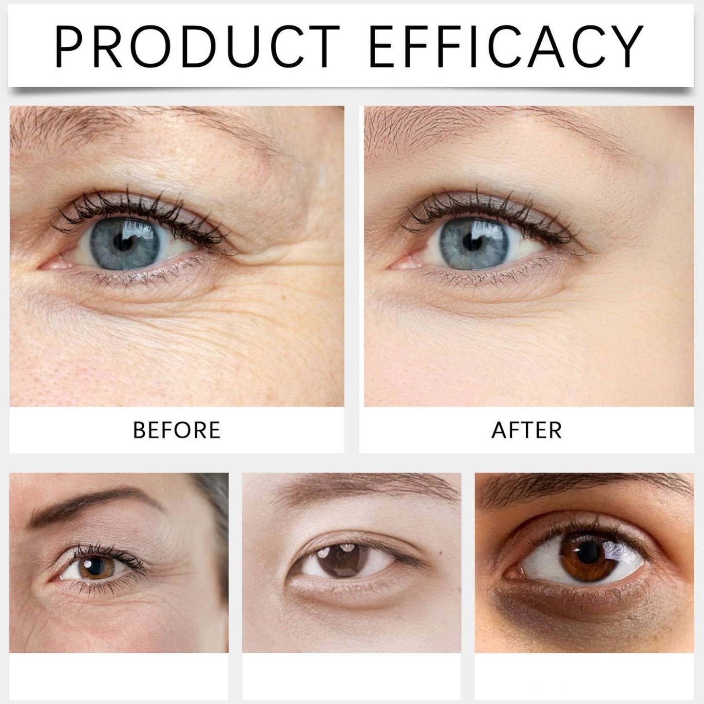 Castor and Frankincense Rollerball Eye Cream for Dark Circles, Puffy Eyes - Anti-Aging Eye Care with Castor Oil