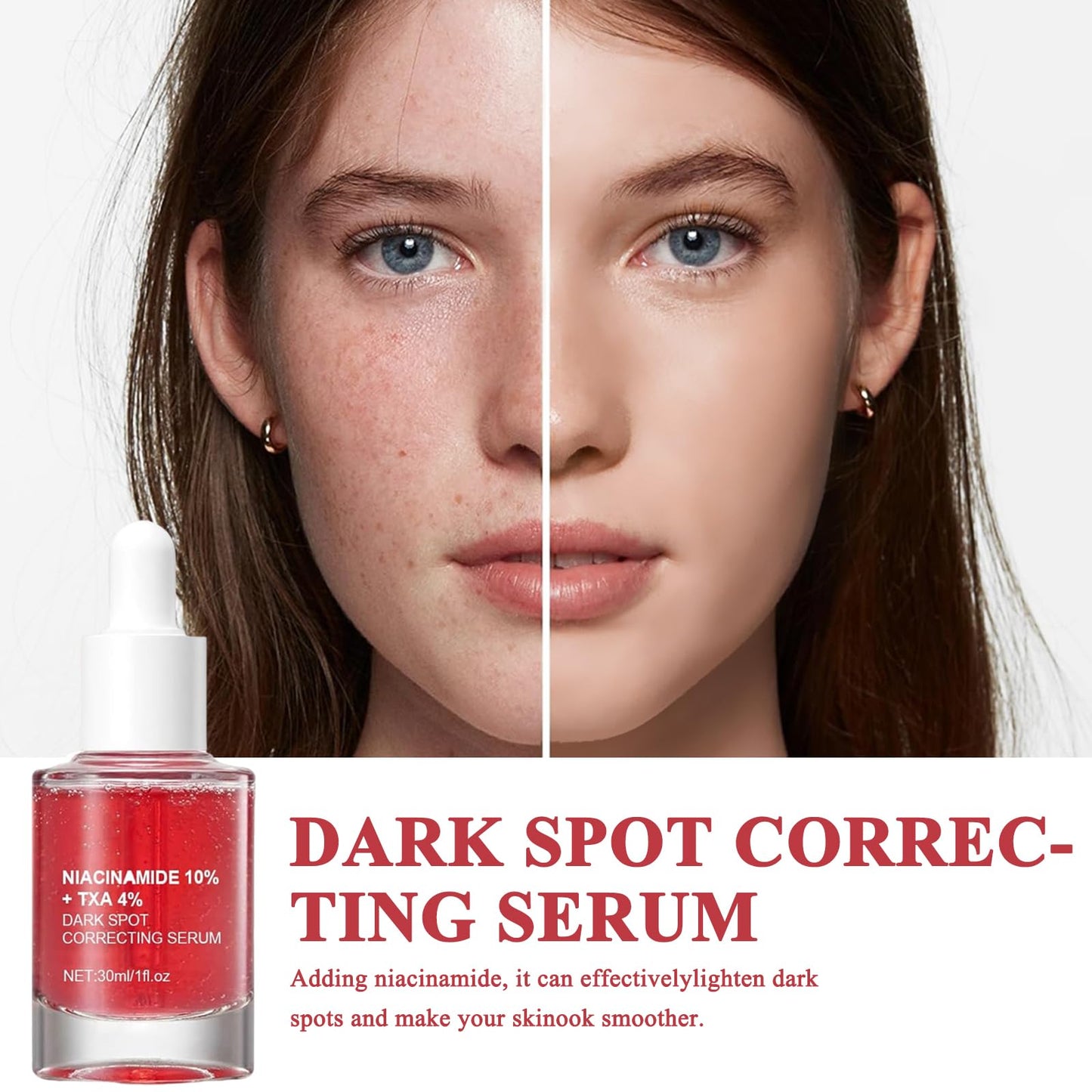 Belligern 2Pcs Dark Spot Correcting Serum,Niacinamide Serum Niacinamide Dark Spot Correcting Serum Targets Signs of Acne With 10% Niacinamide + 4% Tranexamic Acid Even Skin Tone,Fragrance-Free