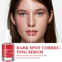 Belligern 2Pcs Dark Spot Correcting Serum,Niacinamide Serum Niacinamide Dark Spot Correcting Serum Targets Signs of Acne With 10% Niacinamide + 4% Tranexamic Acid Even Skin Tone,Fragrance-Free