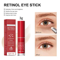 SingHao Retinol Eye Stick,Retinol Eye Cream for Dark Circles,Under Eye Cream Anti Aging,Eye Cre/am for Puffiness,Reducing Fine Lines,E/ye Balm Stick,E/ye Brightener Sti/ck,Smoothens Wrinkle E/ye Cre/am
